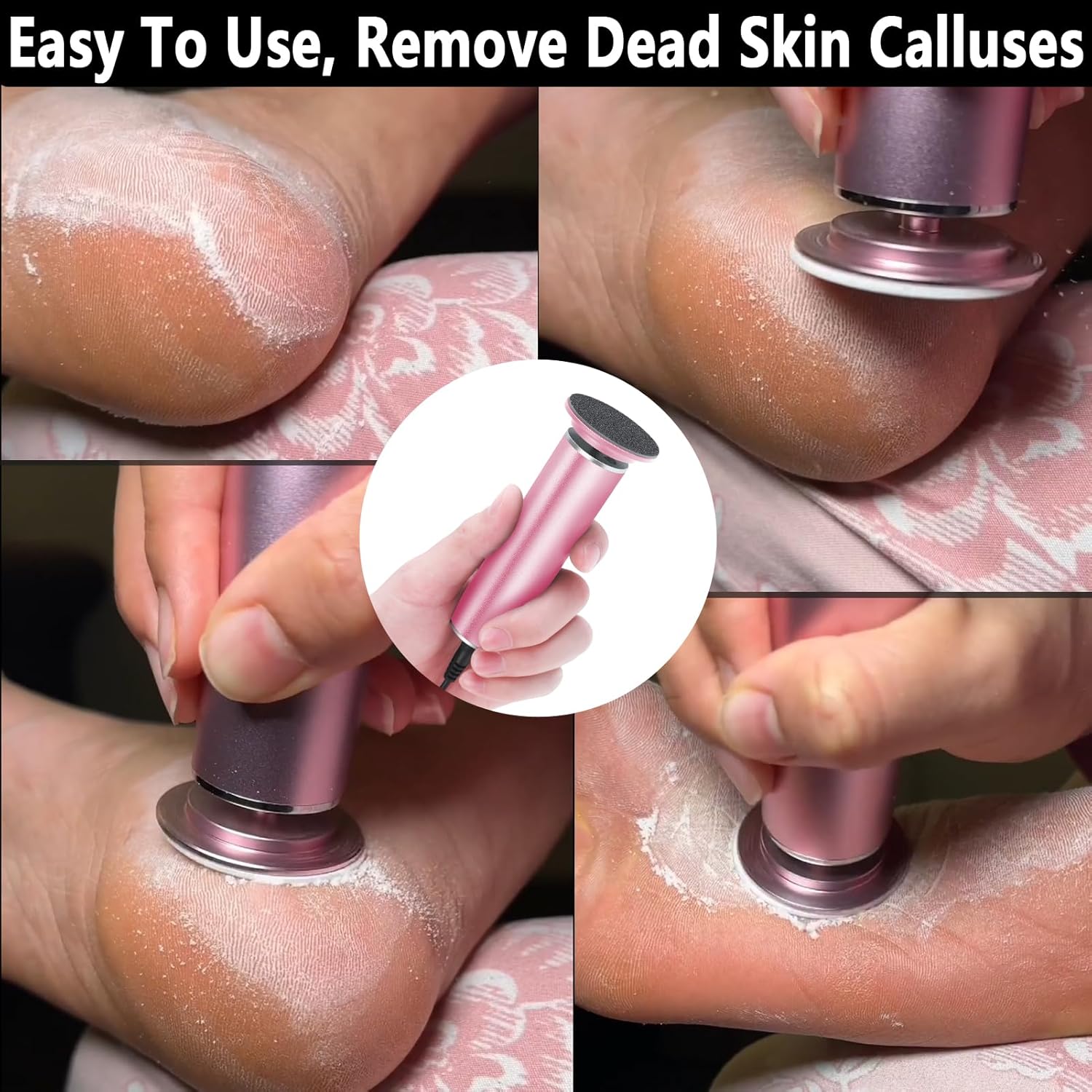 Elektromos Sarokreszelő és Bőrkeményedés-eltávolító – Állítható Sebességgel, Professzionális Pedikűr Eszköz Cserélhető Csiszolókorongokkal